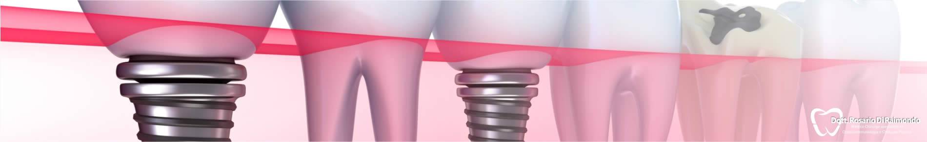 Dott. Rosario Di Raimondo, specialista Odontostomatologia e Chirurgia Plastica a Palermo.