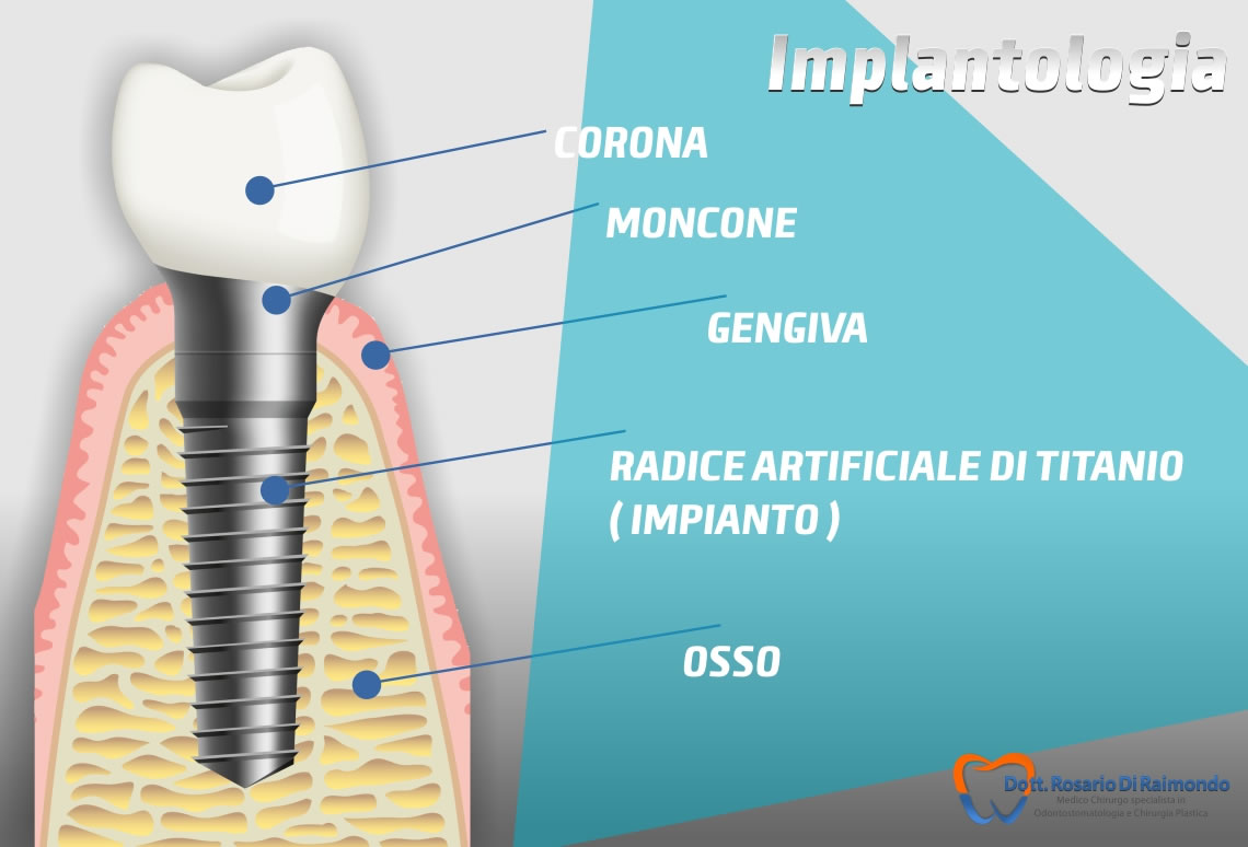 Contatti Dott. Rosario Di Raimondo, dentisa Palermo