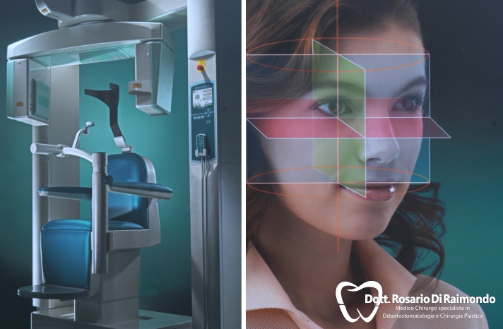 La radiologia in odontoiatria